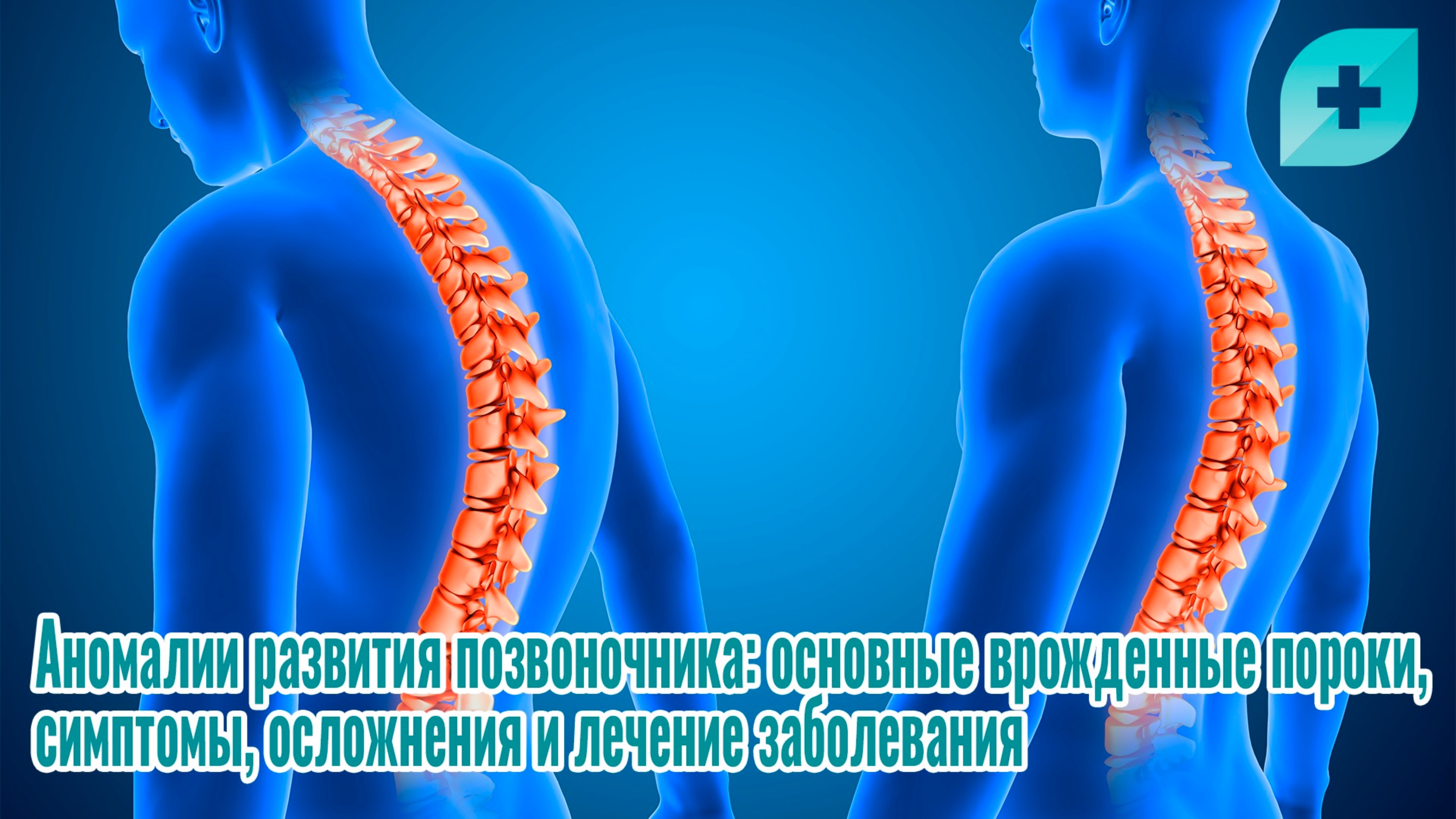 Аномалии развития позвоночника: врожденные пороки, симптомы и лечение заболевания