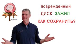 Профилактика травмы межпозвонкового диска