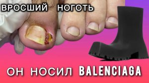 Вросший ноготь и обувь BALENCIAGA