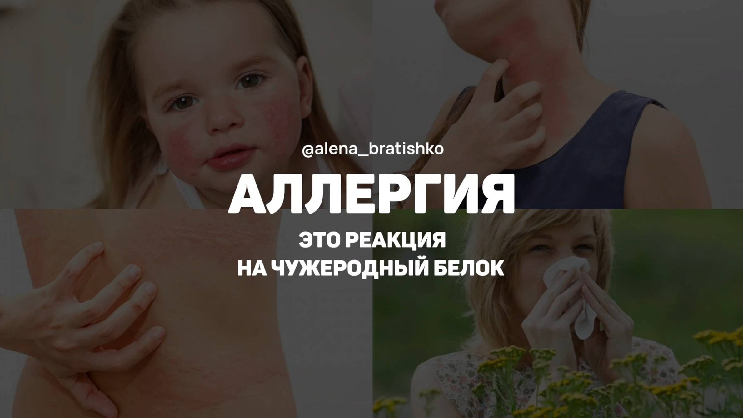 АЛЛЕРГИЯ - ЭТО РЕАКЦИЯ НА ЧУЖЕРОДНЫЙ БЕЛОК. Алена Братишко