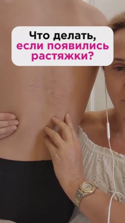 Растяжки на коже! Что делать? #кожа #пшб #иринабаранова