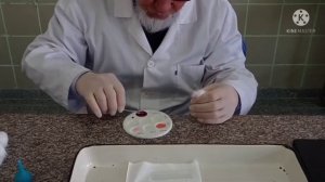 Qon guruhlarini aniqlash.Fiziologiya. Professor Qodirov Sh.Q.