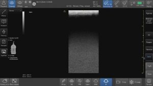 УЗИ  легких у новорожденных для конгресса Трудный пациент в Уфе 08.11.24