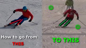 Заиксовка ног