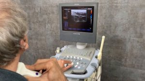 Siemens Acuson X150 Ultrasound: Equipment for Doctors and Clinics || Angelus Medical