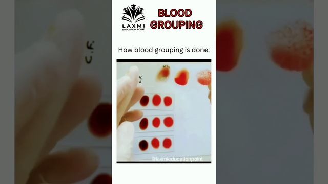 ABO Blood Grouping | class 11th biology| body fluids and circulation| #neet2023#neetbiology#biology