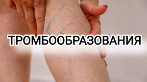 ТРОМБ У ДЕВОЧКИ НА НАЧАЛЬНОЙ СТАДИИ ОБРАЗОВАНИЯ / ПИТАНИЕ И ВИРУСЫ