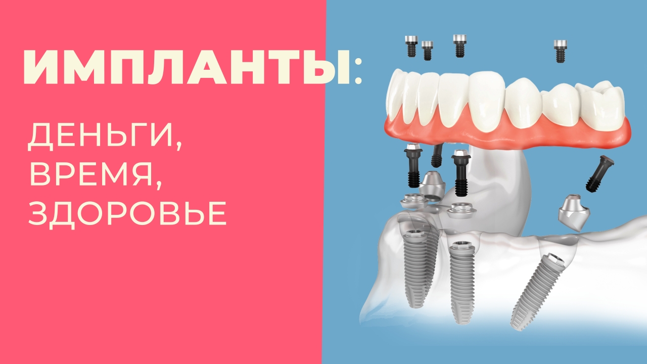 40. Dentures/Съемные зубные протезы: Продолжение серии ответов на ваши вопросы. Импланты? смотреть онлайн
