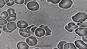 Один стакан воды в день - достаточно ли этого для здоровья организма?