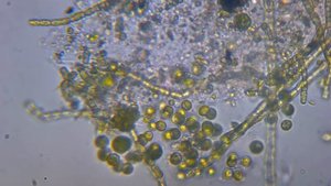 хлореллы под микроскопом