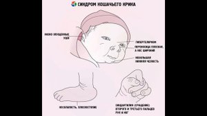 Синдром Кошачий крик