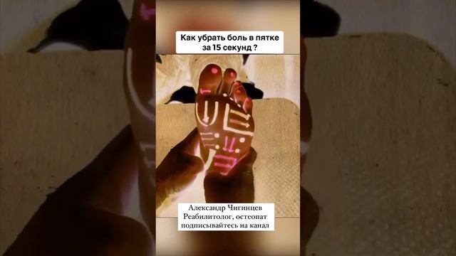 Как убрать боль в пятке за 15 секунд? #боль в пятке # боль # стопа