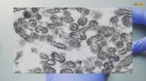 10 Самых Необычных и Таинственных Вирусов На Планете