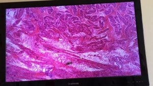 Гистология. Ткани мочевого пузыря