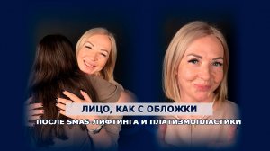 SMAS-лифтинг и платизмопластика - комплексное омоложение