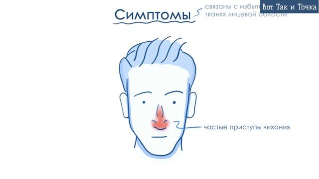 Аллергический ринит   причины, симптомы, лечение