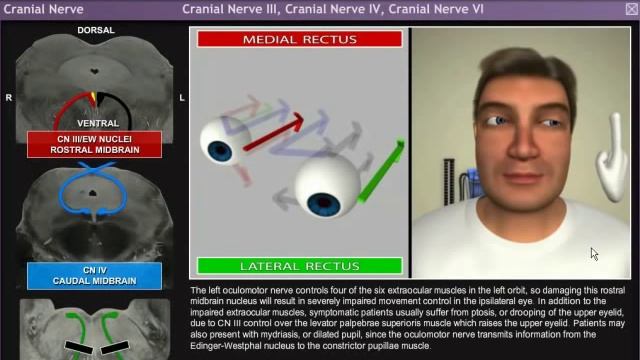 Axiom Neuro 3D Neuroanatomy - Cranial Nerves Module