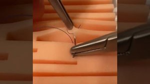 8-образный шов Спасокукоцкого \ 8-shaped seam of Spasokukotsky