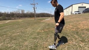 Bilateral Above Knee Amputee - Genium Knee Functions