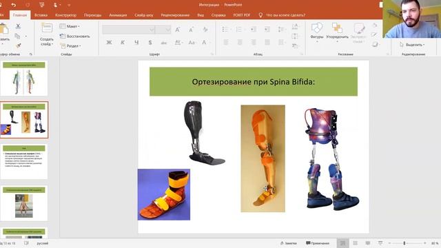 Современные технологии в ортезировании  Ортезы для ходьбы