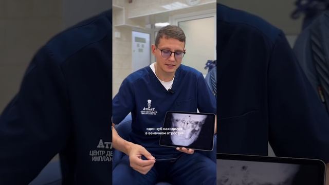 Уникальное удаление зубов - зубы вне полости рта #удалениезубов #зубы #стоматология