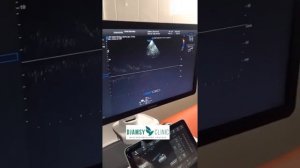 Ультразвуковое исследование сосудов головного мозга.