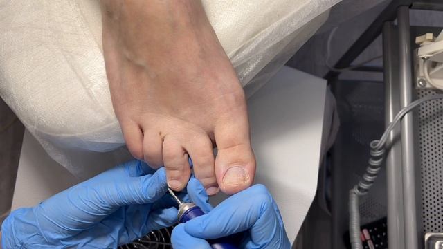 ПЕДИКЮР без покрытия | Обработка стопы песочными колпачками LUKAS смотреть онлайн