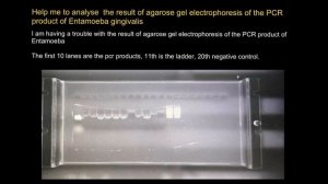 How to analyze result of agarose gel electrophoresis of the PCR product?