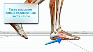 Биомеханика распространённой ходьбы