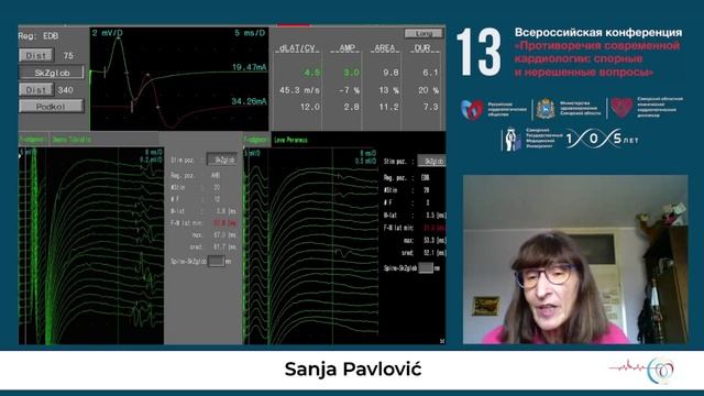 8.11 Сложные ситуации в практике кардиолога.Интернациональный симпозиум друзей