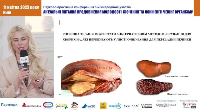 ПЕЧІНКА ТА ВІК. ВПЛИВ ПЕЧІНКОВИХ ФУНКЦІЙ НА ЯКІСТЬ ЖИТТЯ.