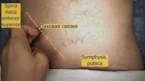 Анатомия паховой связки. Глубокое и поверхностное паховые кольца. Проекция на брюшную стенку