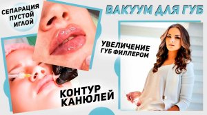 Вакуум для губ / Контур КАНЮЛЕЙ / Сепарация пустой иглой / УВЕЛИЧЕНИЕ ГУБ ФИЛЛЕРОМ