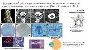 «Теория эволюционной роли наследуемых опухолей – carcino-evo-devo». Гость: Козлов А.П.