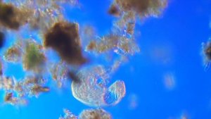 Spirostomum