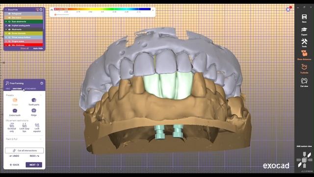 DESIGN DENTAL TEMPORARY CROWN END IBAR. design exocad &b4d ibar#12 смотреть онлайн
