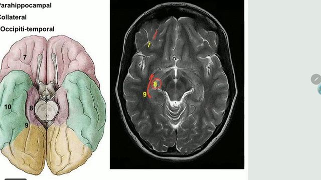 Neuroscience | Neuroanatomy | lecture10 | Cerebrum part 1