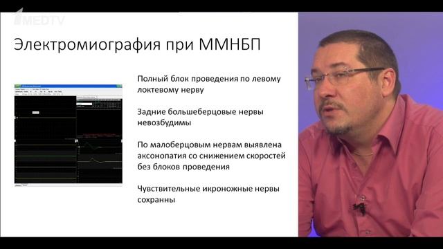 «Мультифокальная моторная невропатия с блоками проведения» Глеб Николаевич Левицкий