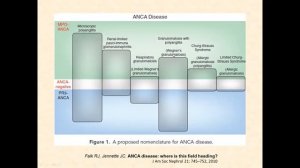 Approach to Crescentic Glomerulonephritis  Dr  Mahesha Vankalakunti