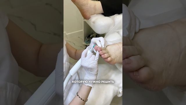 5 строгих «НЕТ» от подолога узнайте в комментариях