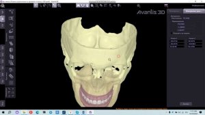 Измерение расстояний