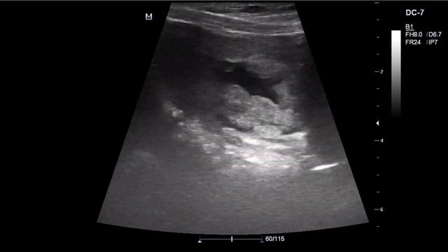 Уз-признаки цистита у кота. смотреть онлайн