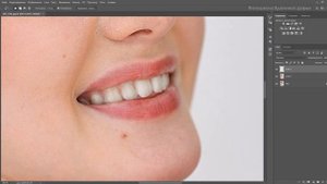 Отбелить зубы в Photoshop