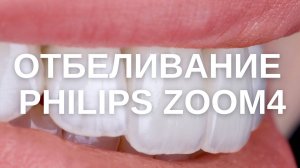 ОТБЕЛИВАНИЕ Philips Zoom4| До и После