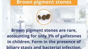 Types of gallstones in children Pigment stones, cholesterol stones, mixed stones - Dr. Kinisha Pate