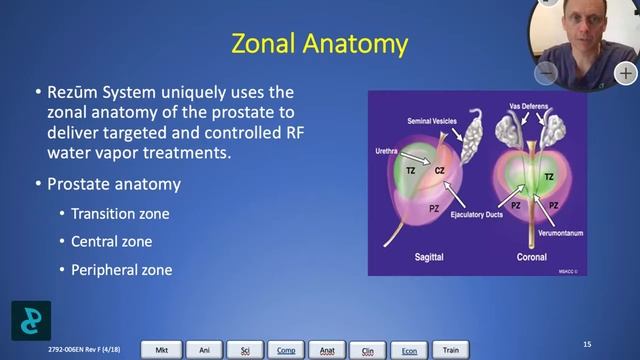 Before you have treatment for an enlarged prostate watch this....Up to date management of BPH 2021 смотреть онлайн