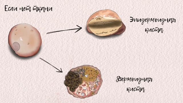 Регенерация и репарация-ч.1 #стволовыеклетки #регенерация #репарации #какэтоустроено #медицина #члх
