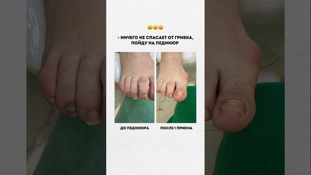ОСТОРОЖНО - это может случиться с каждым  Подробнее в комментариях