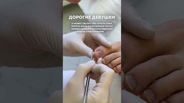 В шоке от того, насколько долго многие девушки терпят проблемы со стопами (в комментариях)