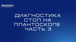Диагностика стоп на плантоскопе. Часть 3